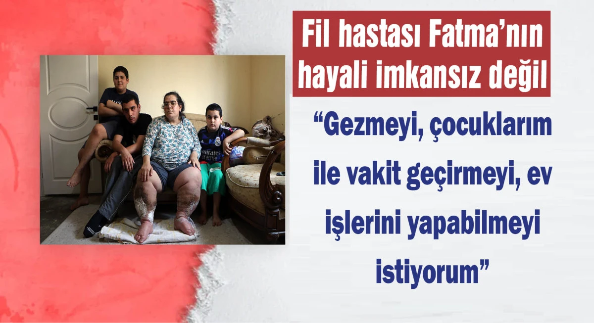 Fil hastası kadın, iyileşip &ccedil;ocuklarıyla ilgilenmek istiyor