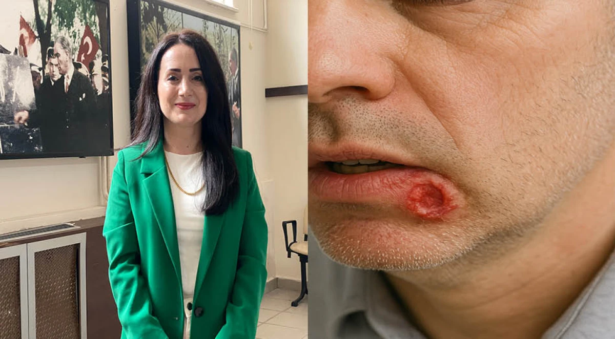 Sigara ve alkol kullanımında 'kanser' tehlikesi