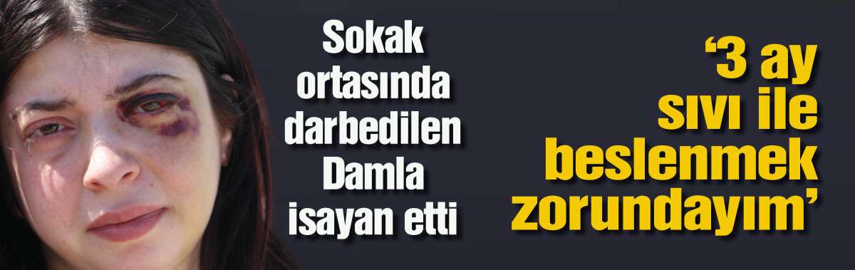 Sokak ortasında darbedilen Damla: 3 ay sıvı ile besleneceğim
