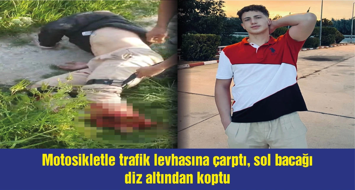 Trafik levhasına çarpan motosikletteki üniversite öğrencisinin bacağı koptu